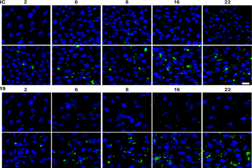 ABC cells